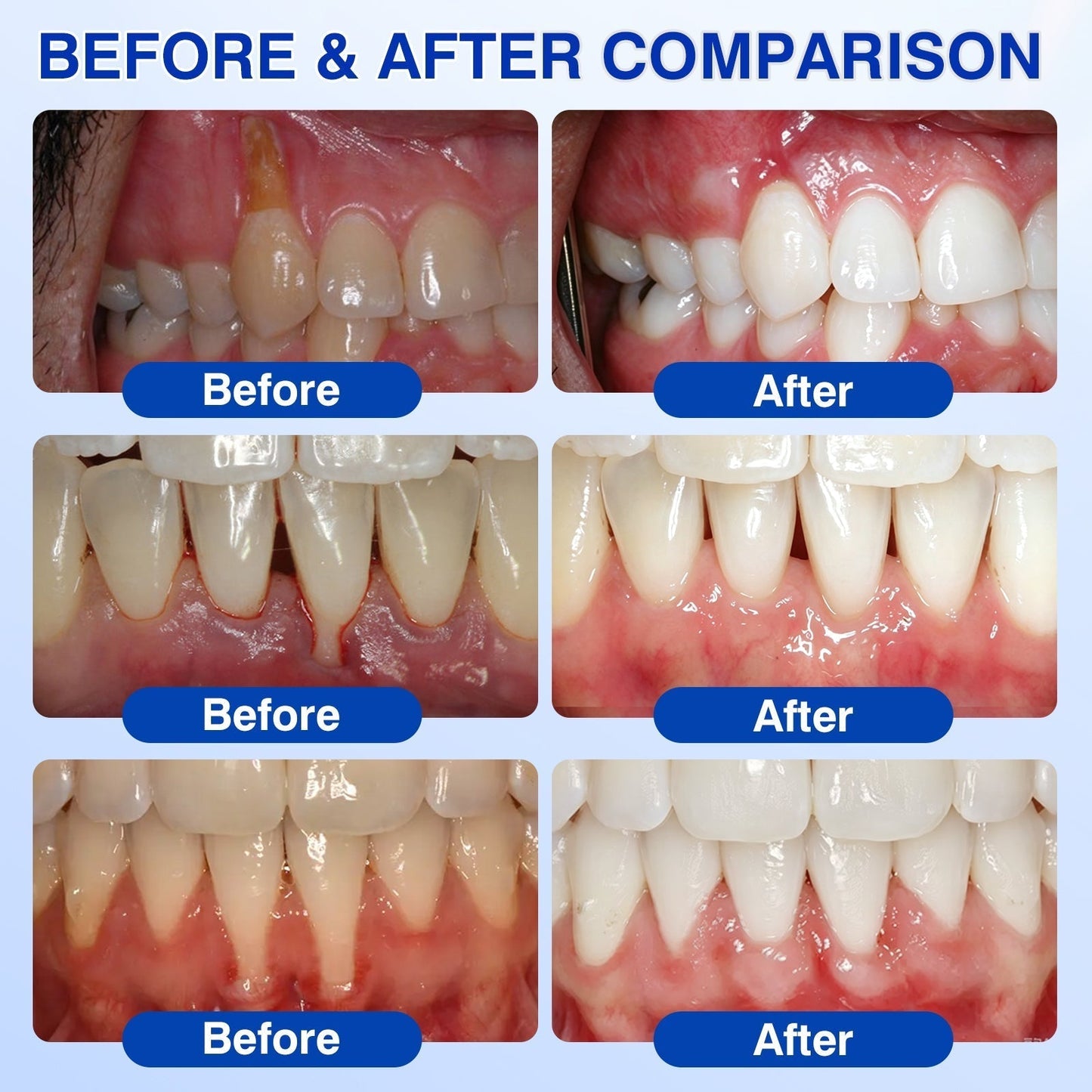 UpSell🏅🦷𝐎𝐟𝐟𝐢𝐜𝐢𝐚𝐥 𝐒𝐭𝐨𝐫𝐞 | 𝐃𝐫.𝐄𝐫𝐚® 𝐆𝐮𝐦𝐑𝐞𝐯𝐢𝐯𝐞 𝐏𝐞𝐫𝐢𝐨𝐝𝐨𝐧𝐭𝐚𝐥 𝐑𝐞𝐩𝐚𝐢𝐫 𝐆𝐞𝐥 — 𝐓𝐚𝐫𝐠𝐞𝐭𝐞𝐝 𝐆𝐮𝐦𝐥𝐢𝐧𝐞 𝐒𝐮𝐩𝐩𝐨𝐫𝐭 𝐟𝐨𝐫 𝐏𝐥𝐚𝐪𝐮𝐞, 𝐂𝐚𝐯𝐢𝐭𝐢𝐞𝐬, 𝐏𝐞𝐫𝐢𝐨𝐝𝐨𝐧𝐭𝐚𝐥 𝐂𝐨𝐧𝐜𝐞𝐫𝐧𝐬, 𝐁𝐚𝐝 𝐁𝐫𝐞𝐚𝐭𝐡 & 𝐖𝐞𝐚𝐤 𝐓𝐞𝐞𝐭𝐡 | 𝐏𝐫𝐞𝐜𝐢𝐬𝐢𝐨𝐧 𝐋𝐞𝐚𝐯𝐞-𝐎𝐧 𝐎𝐫𝐚𝐥 𝐂𝐚𝐫𝐞 𝐅𝐨𝐫𝐦𝐮𝐥𝐚（副本）
