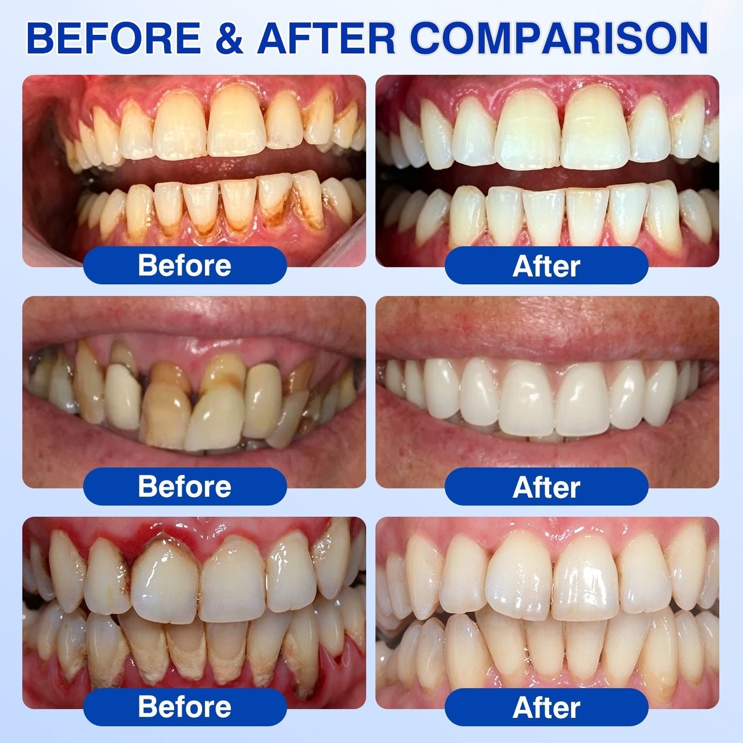 UpSell🏅🦷𝐎𝐟𝐟𝐢𝐜𝐢𝐚𝐥 𝐒𝐭𝐨𝐫𝐞 | 𝐃𝐫.𝐄𝐫𝐚® 𝐆𝐮𝐦𝐑𝐞𝐯𝐢𝐯𝐞 𝐏𝐞𝐫𝐢𝐨𝐝𝐨𝐧𝐭𝐚𝐥 𝐑𝐞𝐩𝐚𝐢𝐫 𝐆𝐞𝐥 — 𝐓𝐚𝐫𝐠𝐞𝐭𝐞𝐝 𝐆𝐮𝐦𝐥𝐢𝐧𝐞 𝐒𝐮𝐩𝐩𝐨𝐫𝐭 𝐟𝐨𝐫 𝐏𝐥𝐚𝐪𝐮𝐞, 𝐂𝐚𝐯𝐢𝐭𝐢𝐞𝐬, 𝐏𝐞𝐫𝐢𝐨𝐝𝐨𝐧𝐭𝐚𝐥 𝐂𝐨𝐧𝐜𝐞𝐫𝐧𝐬, 𝐁𝐚𝐝 𝐁𝐫𝐞𝐚𝐭𝐡 & 𝐖𝐞𝐚𝐤 𝐓𝐞𝐞𝐭𝐡 | 𝐏𝐫𝐞𝐜𝐢𝐬𝐢𝐨𝐧 𝐋𝐞𝐚𝐯𝐞-𝐎𝐧 𝐎𝐫𝐚𝐥 𝐂𝐚𝐫𝐞 𝐅𝐨𝐫𝐦𝐮𝐥𝐚（副本）