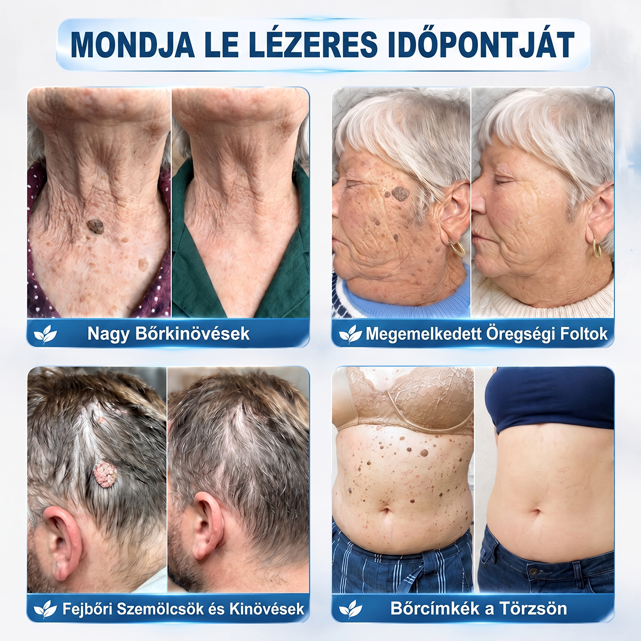 🌿 HiSkin® 🎁 Egy utolsó, még jobb ajánlat! Szerezz be most egy extra HiSkin®-t 50% kedvezménnyel, hogy megszakítás nélkül folytathasd a kezelést.