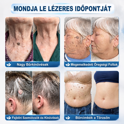 🌿 HiSkin® 🎁 Egy utolsó, még jobb ajánlat! Szerezz be most egy extra HiSkin®-t 50% kedvezménnyel, hogy megszakítás nélkül folytathasd a kezelést.