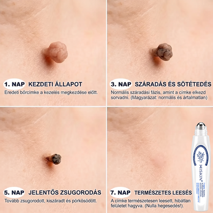 🌿 HiSkin® 🎁 Egy utolsó, még jobb ajánlat! Szerezz be most egy extra HiSkin®-t 50% kedvezménnyel, hogy megszakítás nélkül folytathasd a kezelést.