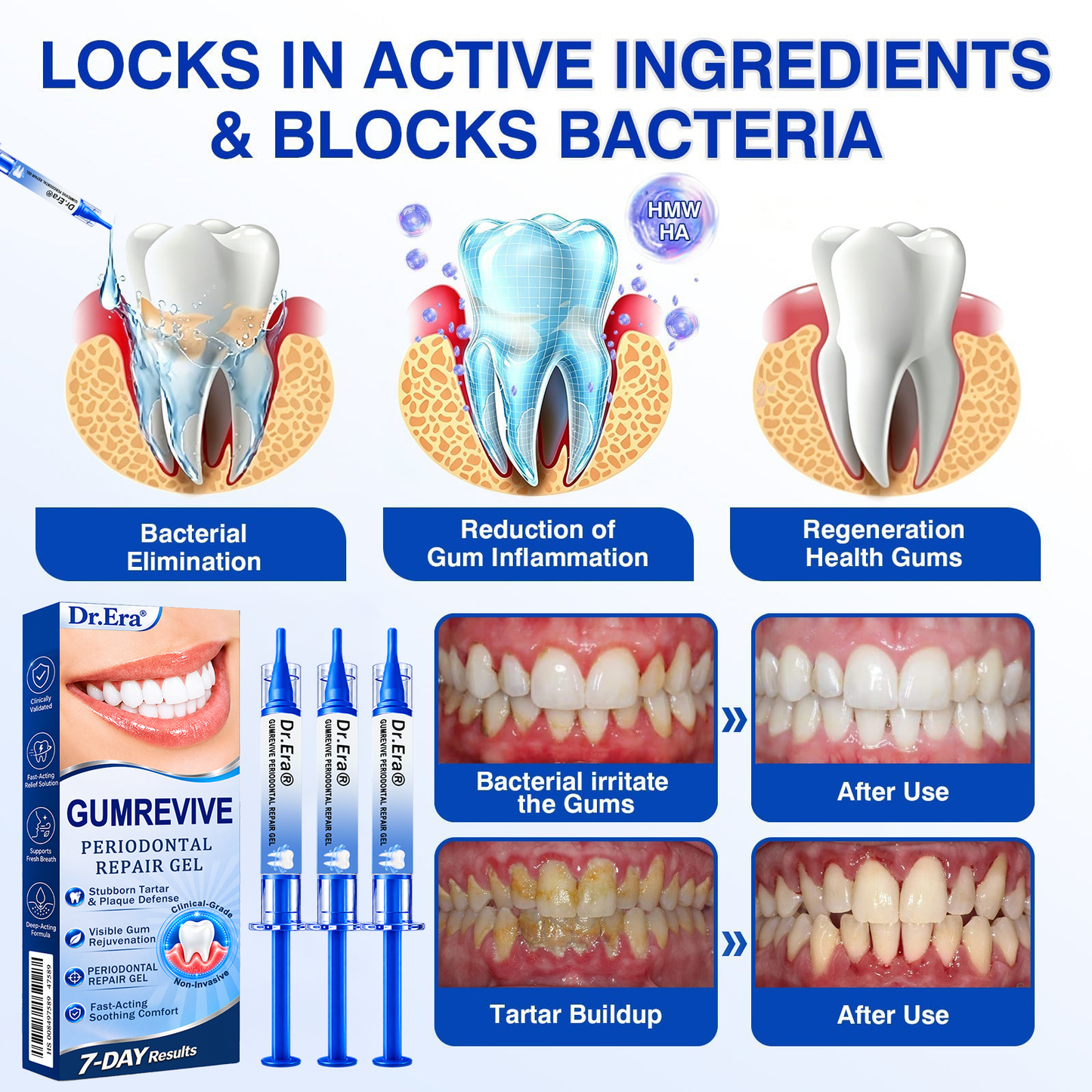 UpSell🏅🦷𝐎𝐟𝐟𝐢𝐜𝐢𝐚𝐥 𝐒𝐭𝐨𝐫𝐞 | 𝐃𝐫.𝐄𝐫𝐚® 𝐆𝐮𝐦𝐑𝐞𝐯𝐢𝐯𝐞 𝐏𝐞𝐫𝐢𝐨𝐝𝐨𝐧𝐭𝐚𝐥 𝐑𝐞𝐩𝐚𝐢𝐫 𝐆𝐞𝐥 — 𝐓𝐚𝐫𝐠𝐞𝐭𝐞𝐝 𝐆𝐮𝐦𝐥𝐢𝐧𝐞 𝐒𝐮𝐩𝐩𝐨𝐫𝐭 𝐟𝐨𝐫 𝐏𝐥𝐚𝐪𝐮𝐞, 𝐂𝐚𝐯𝐢𝐭𝐢𝐞𝐬, 𝐏𝐞𝐫𝐢𝐨𝐝𝐨𝐧𝐭𝐚𝐥 𝐂𝐨𝐧𝐜𝐞𝐫𝐧𝐬, 𝐁𝐚𝐝 𝐁𝐫𝐞𝐚𝐭𝐡 & 𝐖𝐞𝐚𝐤 𝐓𝐞𝐞𝐭𝐡 | 𝐏𝐫𝐞𝐜𝐢𝐬𝐢𝐨𝐧 𝐋𝐞𝐚𝐯𝐞-𝐎𝐧 𝐎𝐫𝐚𝐥 𝐂𝐚𝐫𝐞 𝐅𝐨𝐫𝐦𝐮𝐥𝐚（副本）