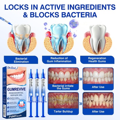 UpSell🏅🦷𝐎𝐟𝐟𝐢𝐜𝐢𝐚𝐥 𝐒𝐭𝐨𝐫𝐞 | 𝐃𝐫.𝐄𝐫𝐚® 𝐆𝐮𝐦𝐑𝐞𝐯𝐢𝐯𝐞 𝐏𝐞𝐫𝐢𝐨𝐝𝐨𝐧𝐭𝐚𝐥 𝐑𝐞𝐩𝐚𝐢𝐫 𝐆𝐞𝐥 — 𝐓𝐚𝐫𝐠𝐞𝐭𝐞𝐝 𝐆𝐮𝐦𝐥𝐢𝐧𝐞 𝐒𝐮𝐩𝐩𝐨𝐫𝐭 𝐟𝐨𝐫 𝐏𝐥𝐚𝐪𝐮𝐞, 𝐂𝐚𝐯𝐢𝐭𝐢𝐞𝐬, 𝐏𝐞𝐫𝐢𝐨𝐝𝐨𝐧𝐭𝐚𝐥 𝐂𝐨𝐧𝐜𝐞𝐫𝐧𝐬, 𝐁𝐚𝐝 𝐁𝐫𝐞𝐚𝐭𝐡 & 𝐖𝐞𝐚𝐤 𝐓𝐞𝐞𝐭𝐡 | 𝐏𝐫𝐞𝐜𝐢𝐬𝐢𝐨𝐧 𝐋𝐞𝐚𝐯𝐞-𝐎𝐧 𝐎𝐫𝐚𝐥 𝐂𝐚𝐫𝐞 𝐅𝐨𝐫𝐦𝐮𝐥𝐚（副本）